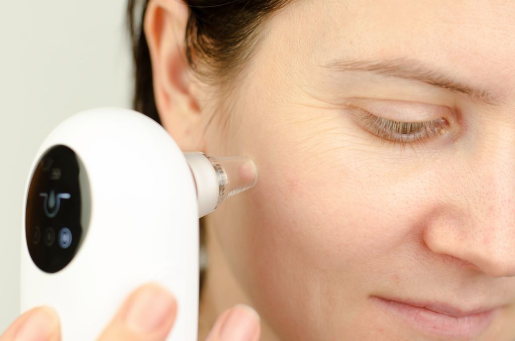 What is a Pore Vacuum?